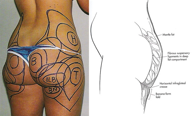엉덩이와 허벅지부위의 명칭과 해부학적 구조