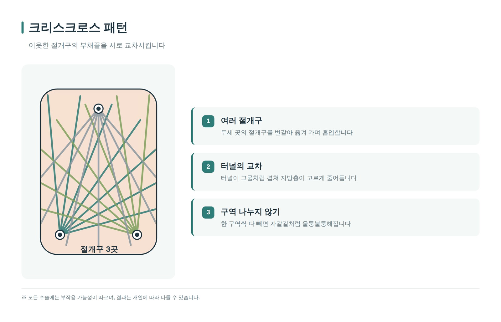 크리스크로스 패턴 도해 — 이웃한 절개구 세 곳의 부채꼴 터널이 서로 교차