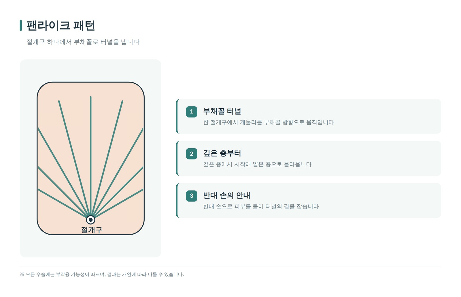 팬라이크 패턴 도해 — 절개구 하나에서 부채꼴로 퍼지는 터널