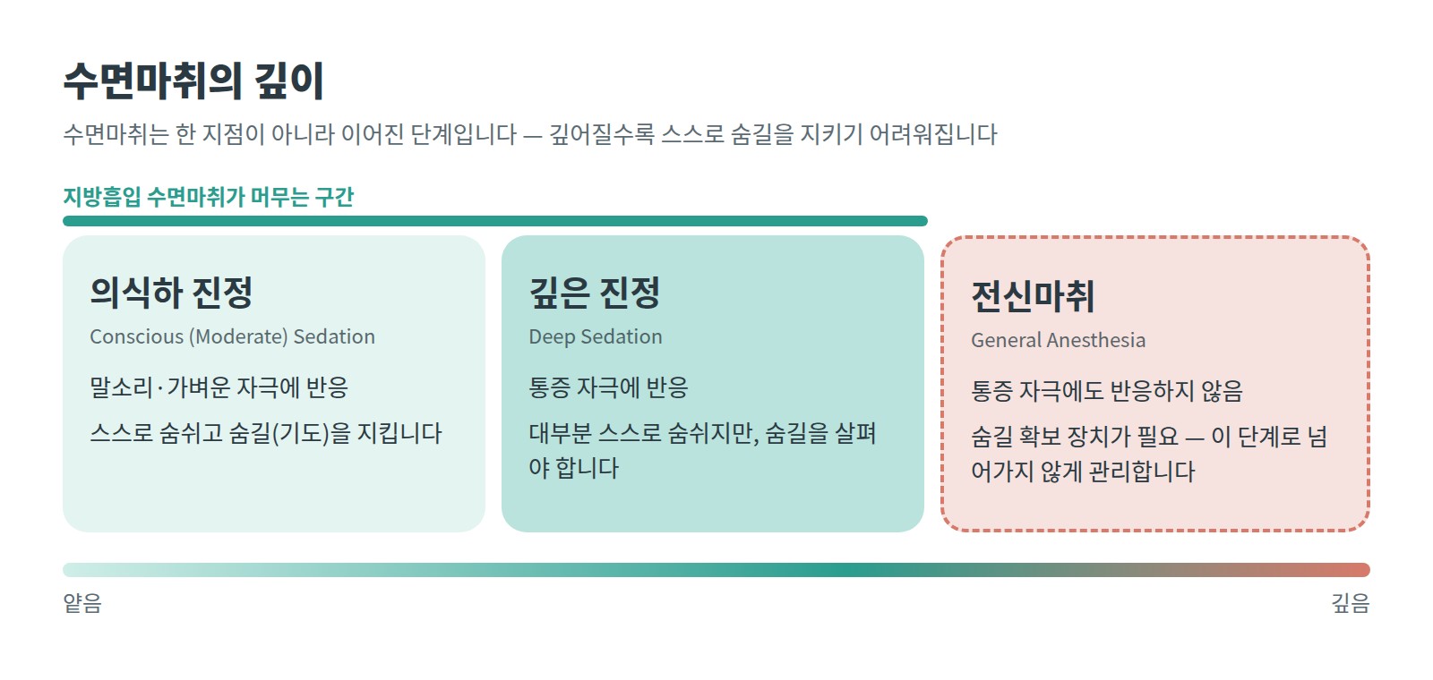 수면마취의 깊이 — 의식하 진정, 깊은 진정, 전신마취 단계 도해