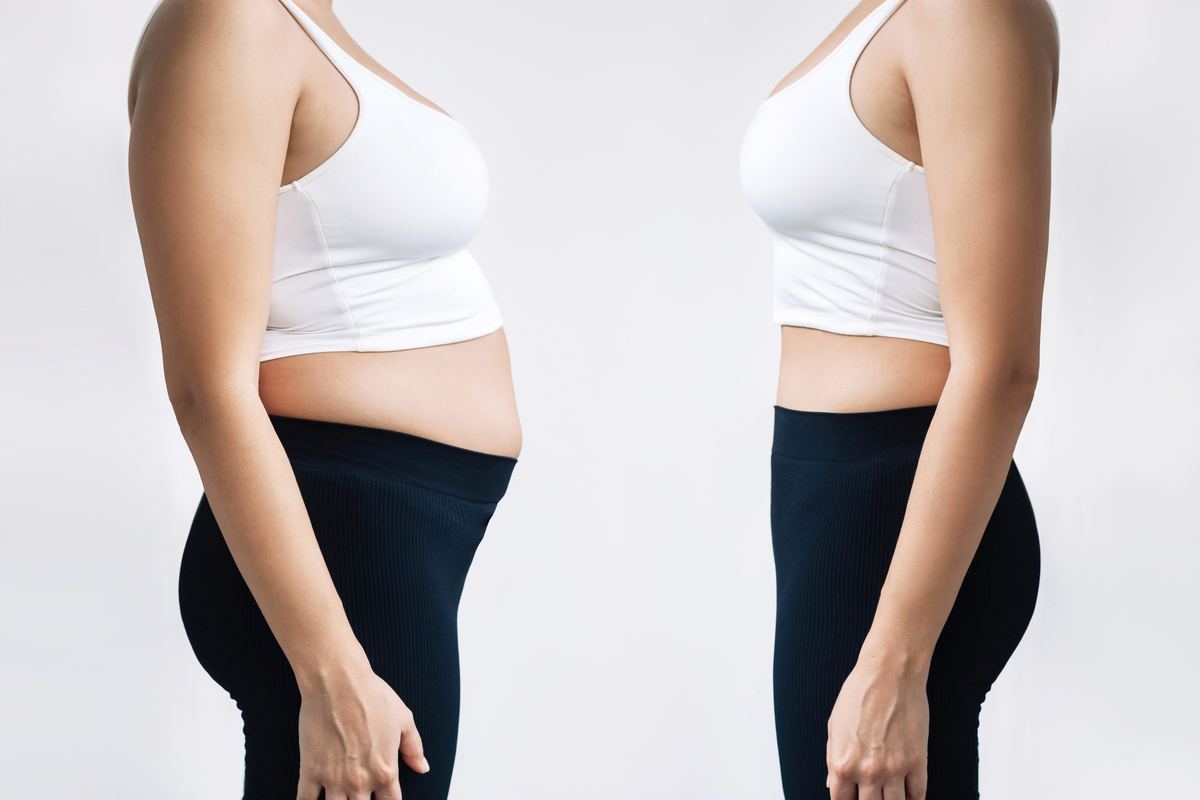 woman-with-belly-with-excess-fat-toned-slim-stomach-before-after-losing-weight-comparison.jpg