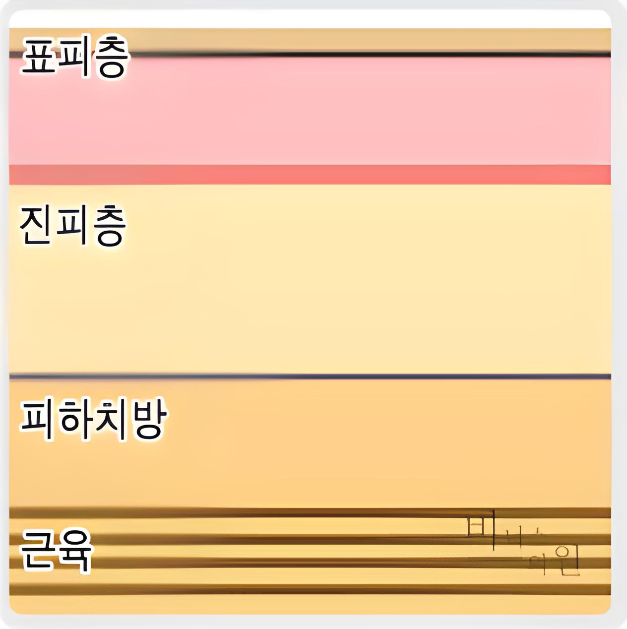 유방 표피층 진피층 피하지방층 근육 구조 설명 표층 지방흡입 원리