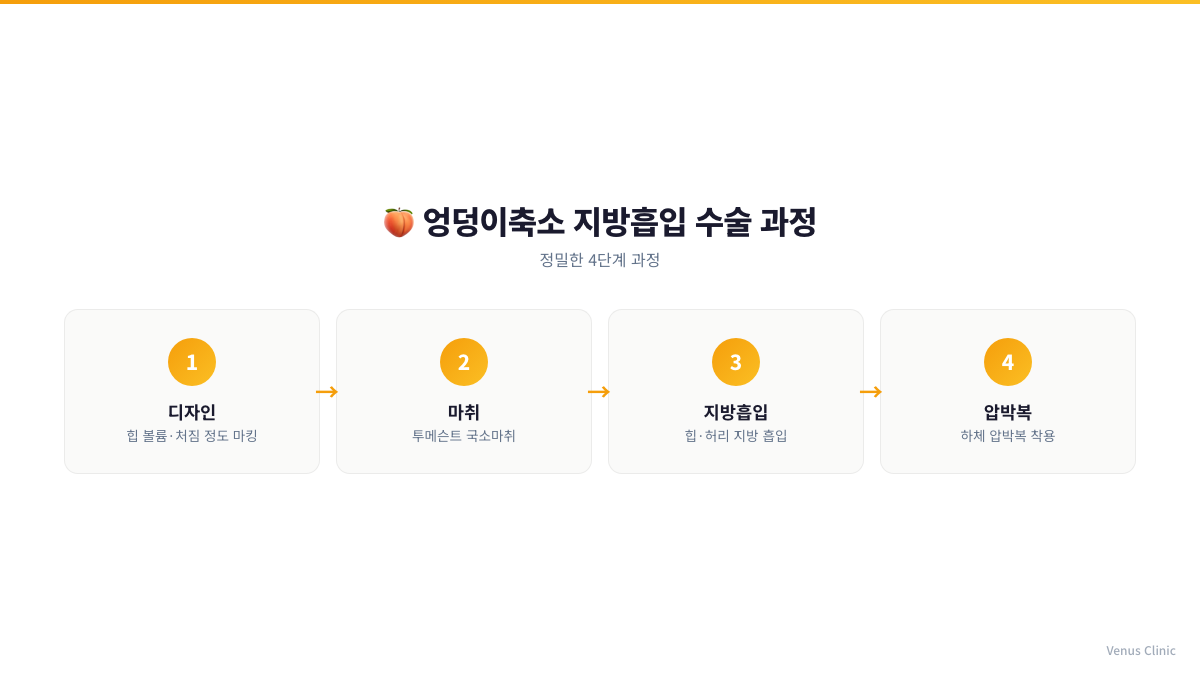 엉덩이축소 지방흡입 수술 과정 4단계 인포그래픽 비너스의원