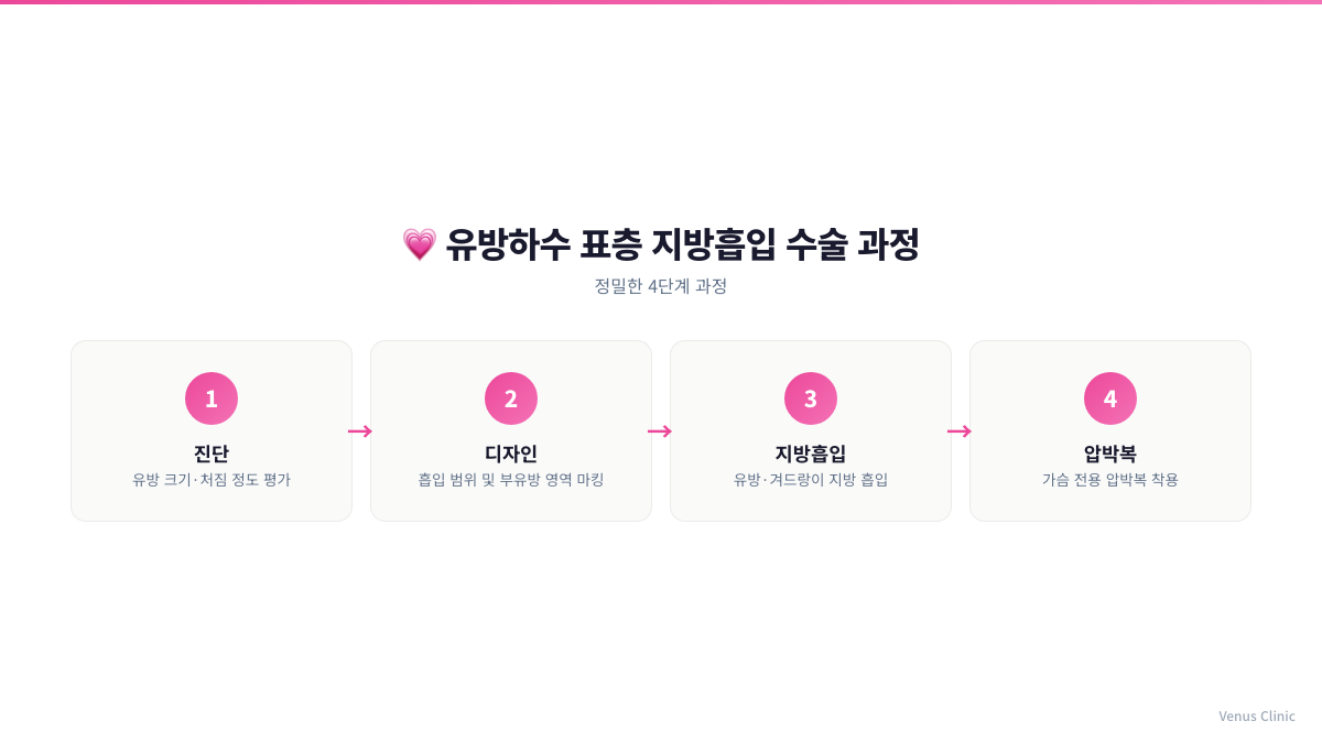 유방하수 표층 지방흡입 수술 4단계 과정 인포그래픽