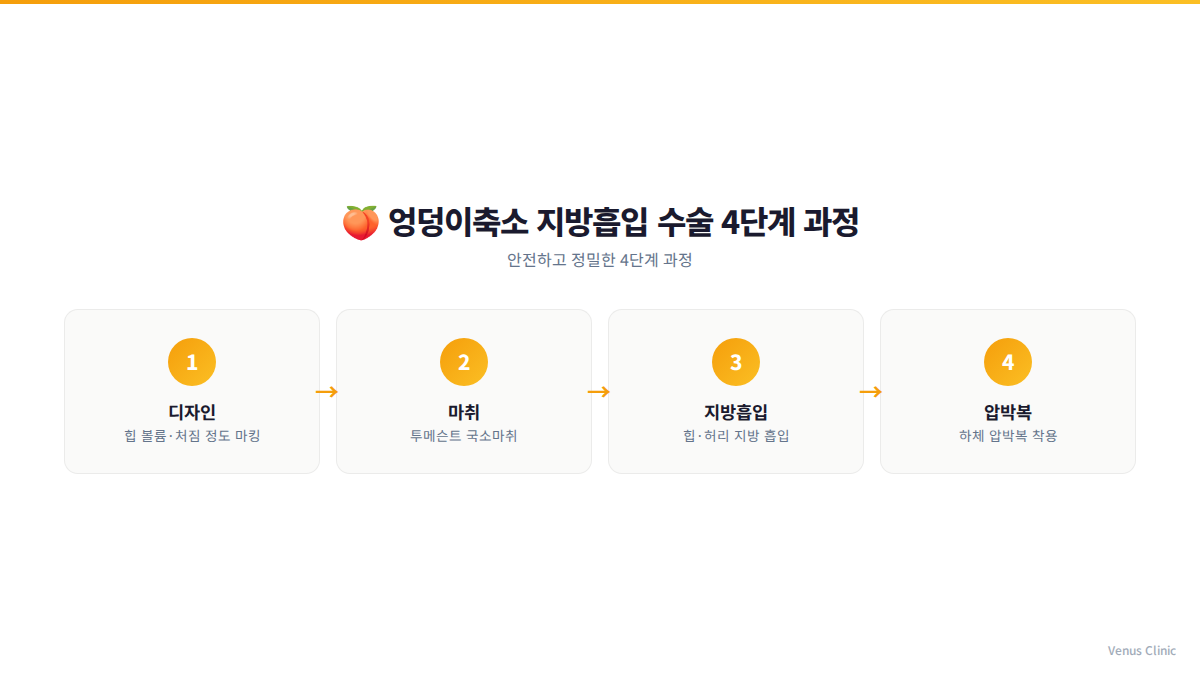 엉덩이 지방흡입 수술 4단계 과정 인포그래픽 비너스의원 부천