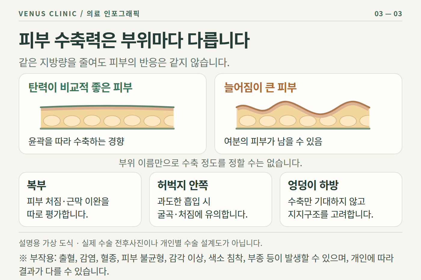 엉덩이 지방흡입 후 관리와 상담 비너스의원