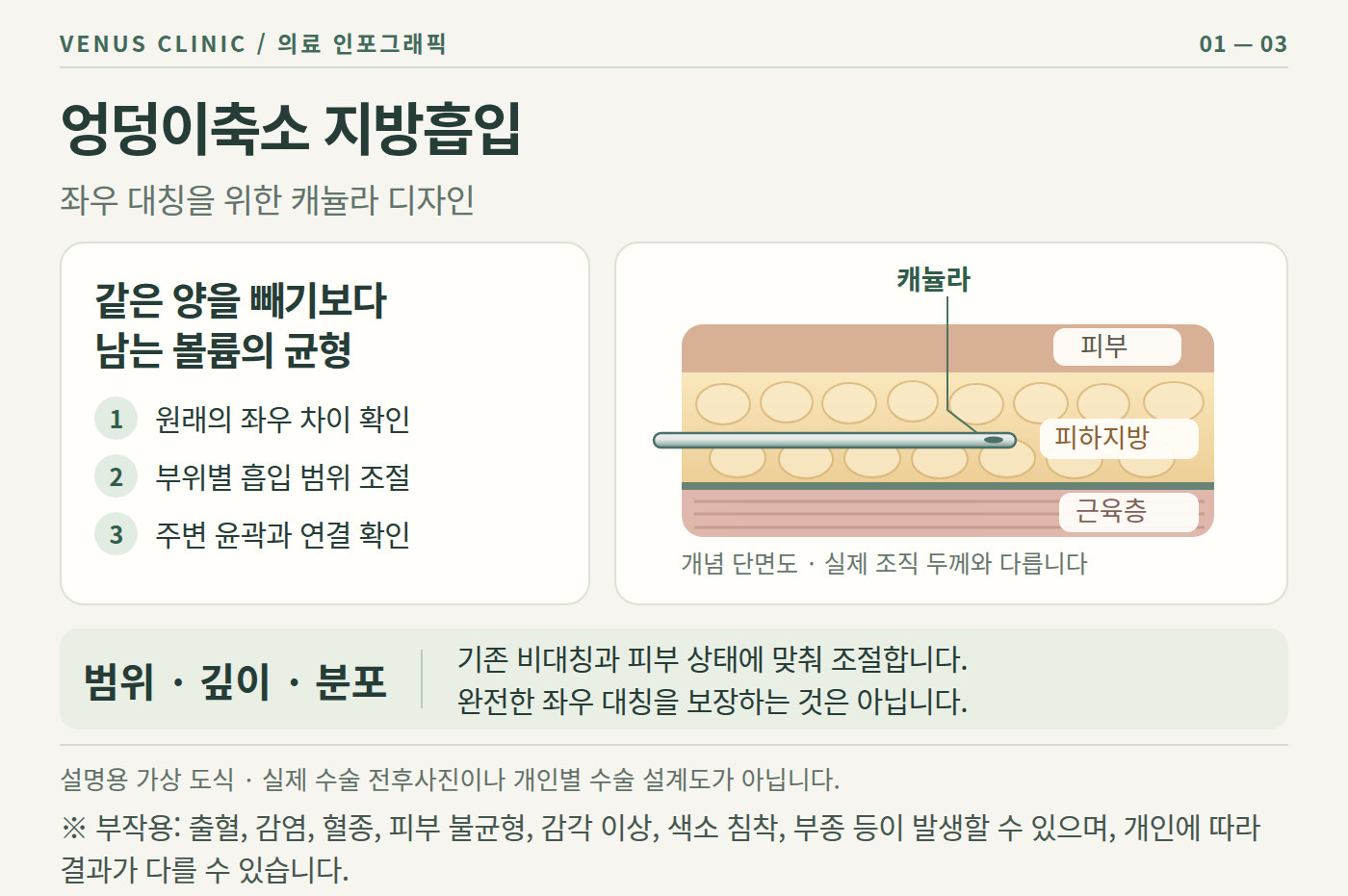 엉덩이 체형 고민과 지방흡입 상담 비너스의원