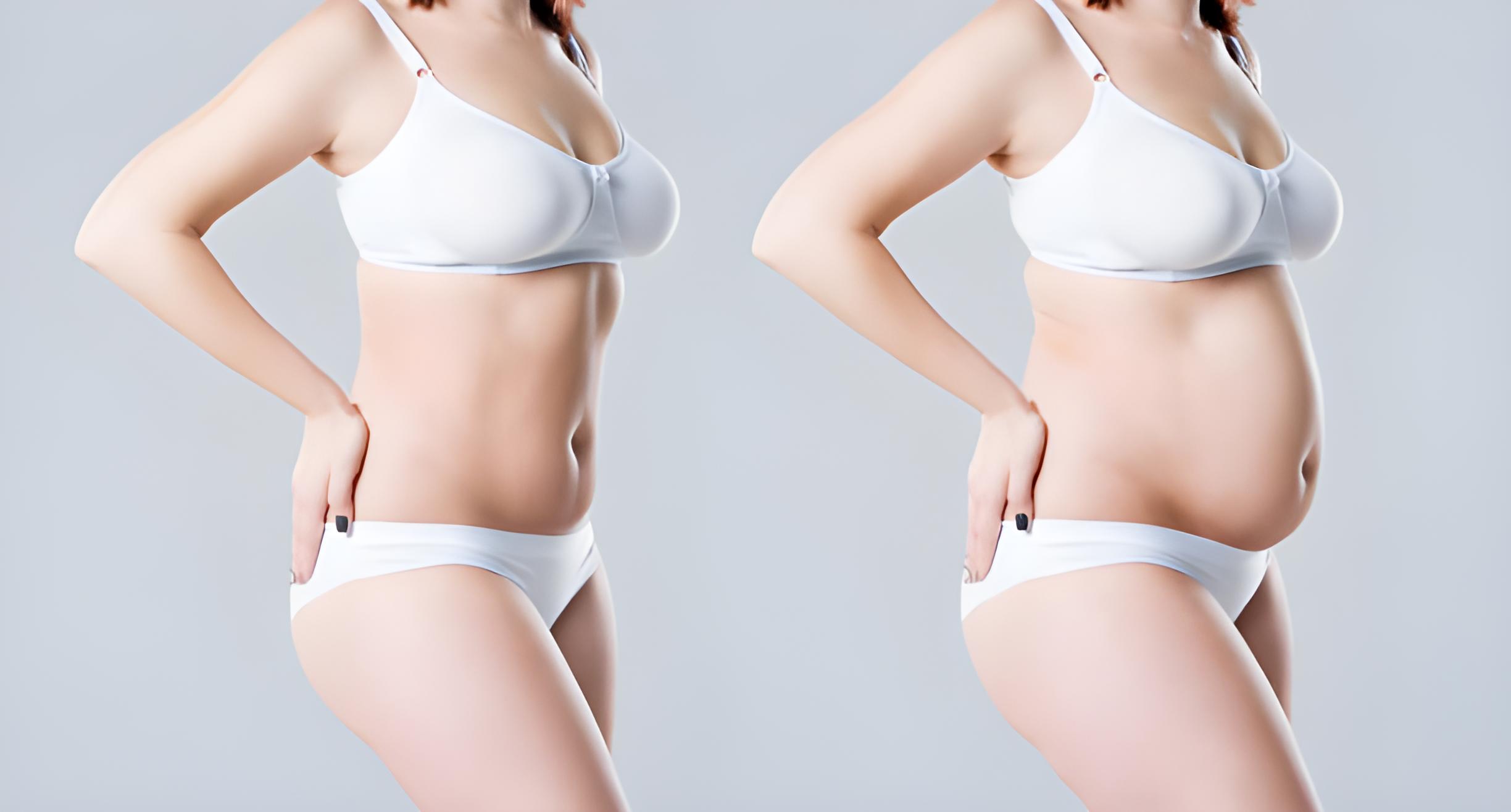 복부 지방흡입 수술 단계 과정 이미지 비너스의원