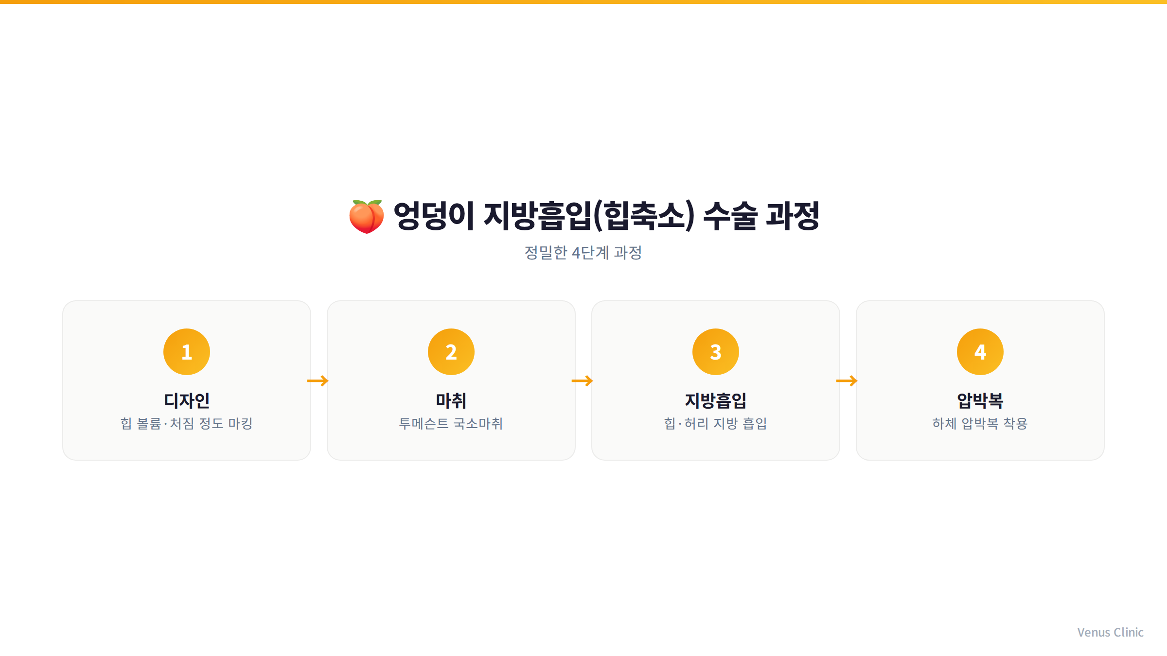 엉덩이축소 지방흡입 수술 4단계 과정 인포그래픽
