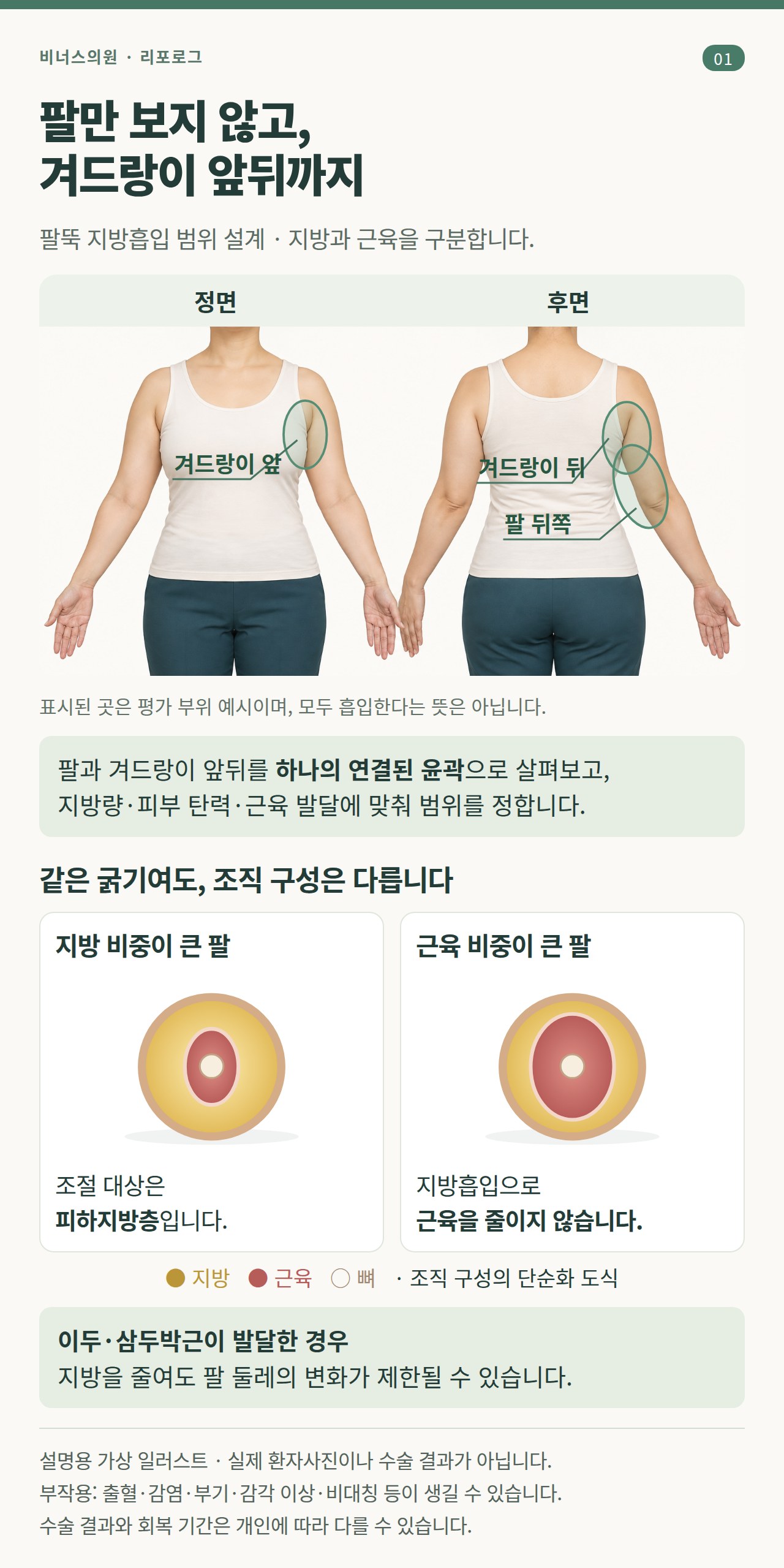 팔뚝 지방흡입 범위 설계와 지방·근육 구성 차이를 설명하는 가상 일러스트