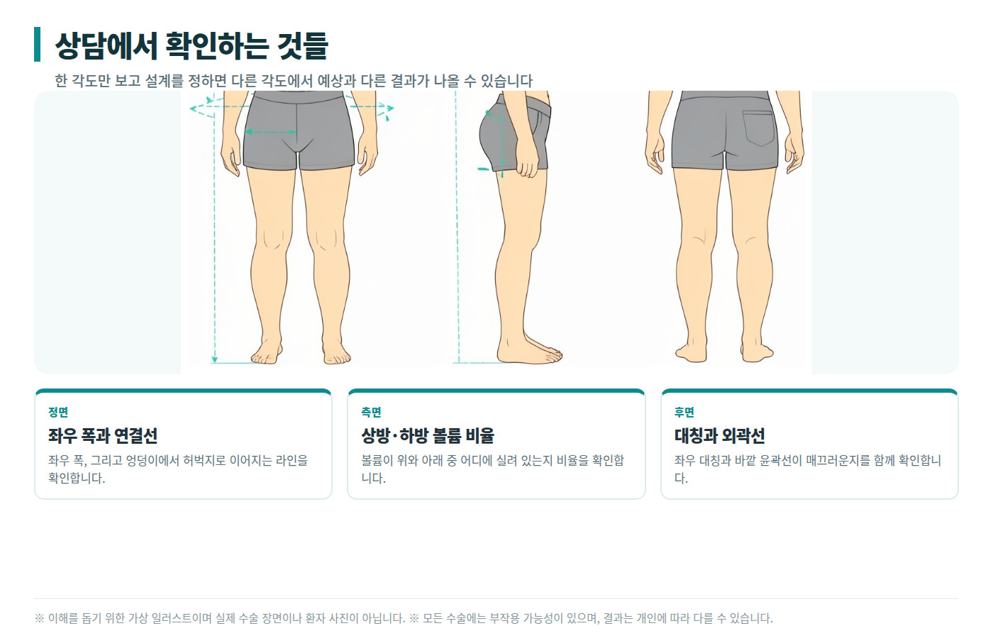 엉덩이축소 지방흡입 상담 확인 항목 인포그래픽 — 정면·측면·후면 각도별 확인
