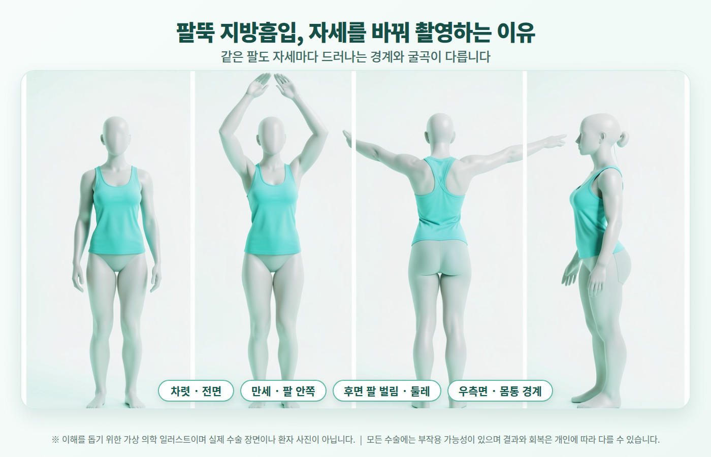 팔뚝 지방흡입을 고민하는 체형 이미지