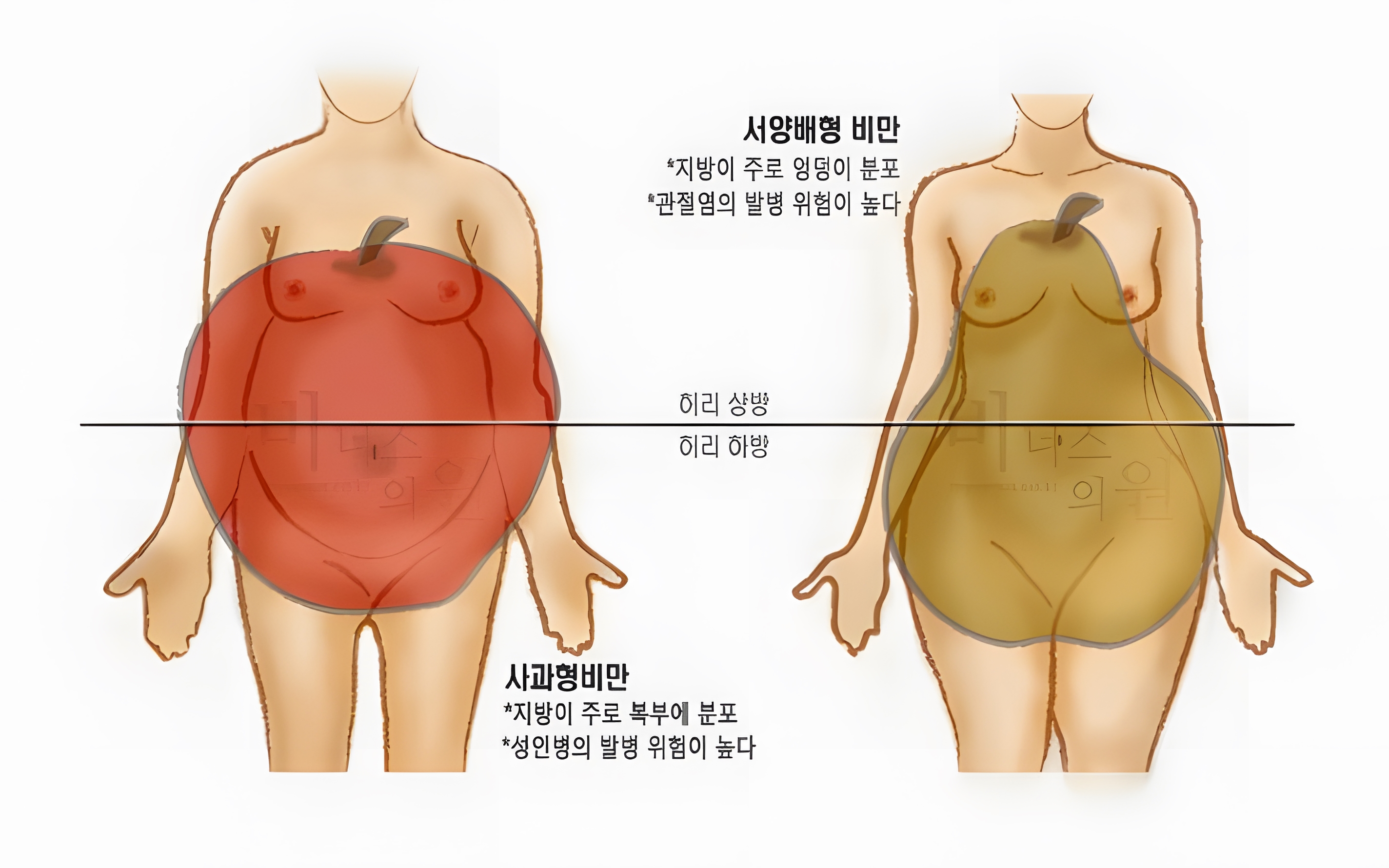 복부 피하지방 구조 설명 이미지 지방층 해부학 비너스의원
