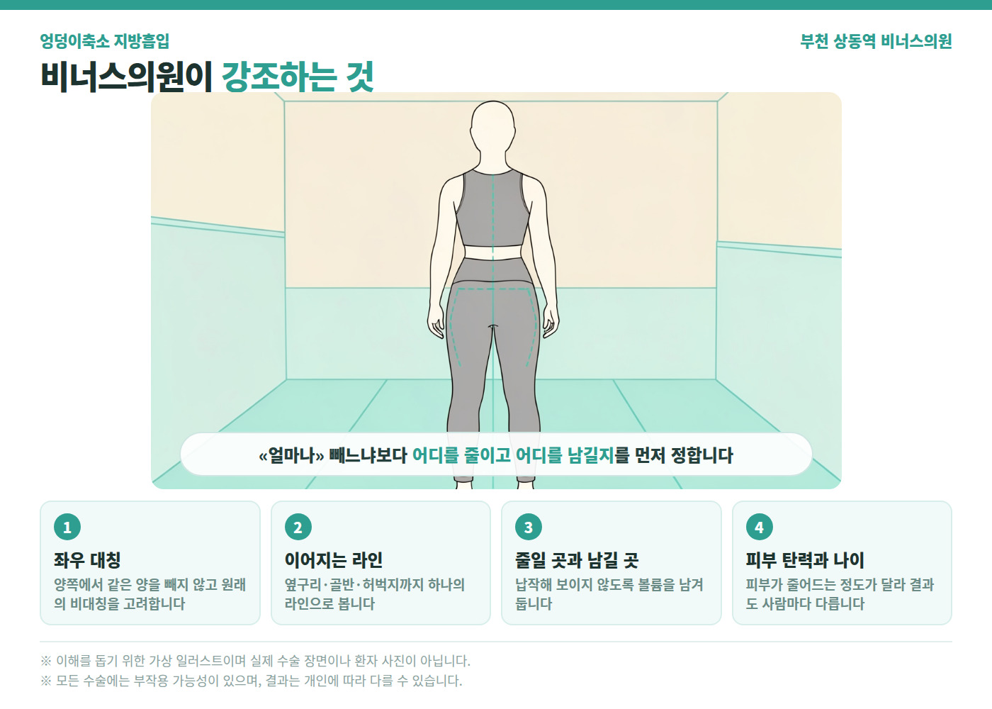 비너스의원 엉덩이축소 지방흡입 설계 원칙 의학 인포그래픽