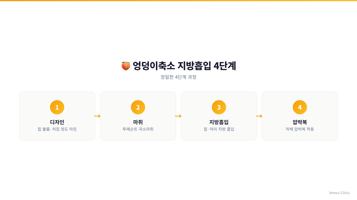엉덩이축소 지방흡입 4단계 과정 인포그래픽