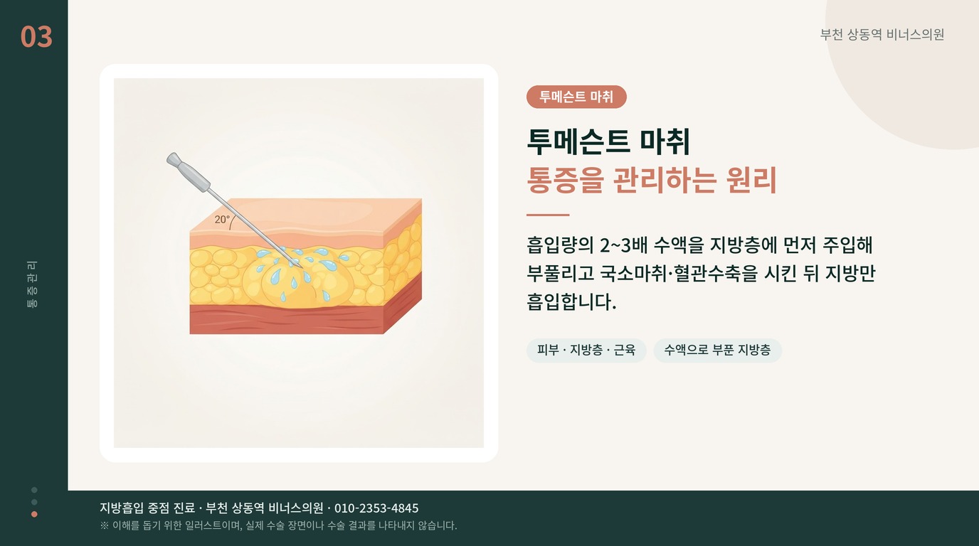 투메슨트 마취 통증을 관리하는 원리 인포그래픽 비너스의원