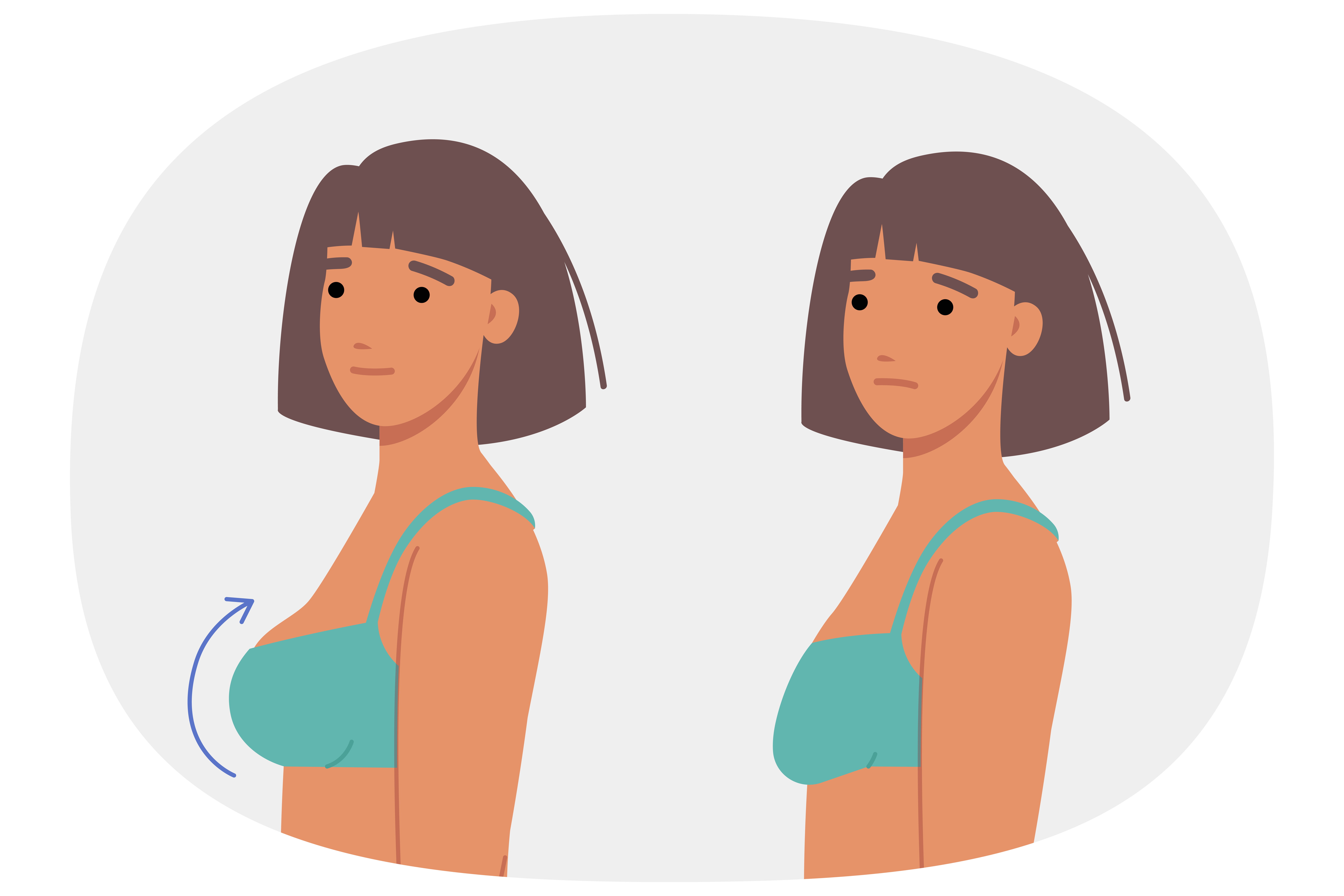 유방 사이즈 변화를 보여주는 참고용 스톡 일러스트(실제 환자 또는 시술 전후 결과가 아님) 비너스의원