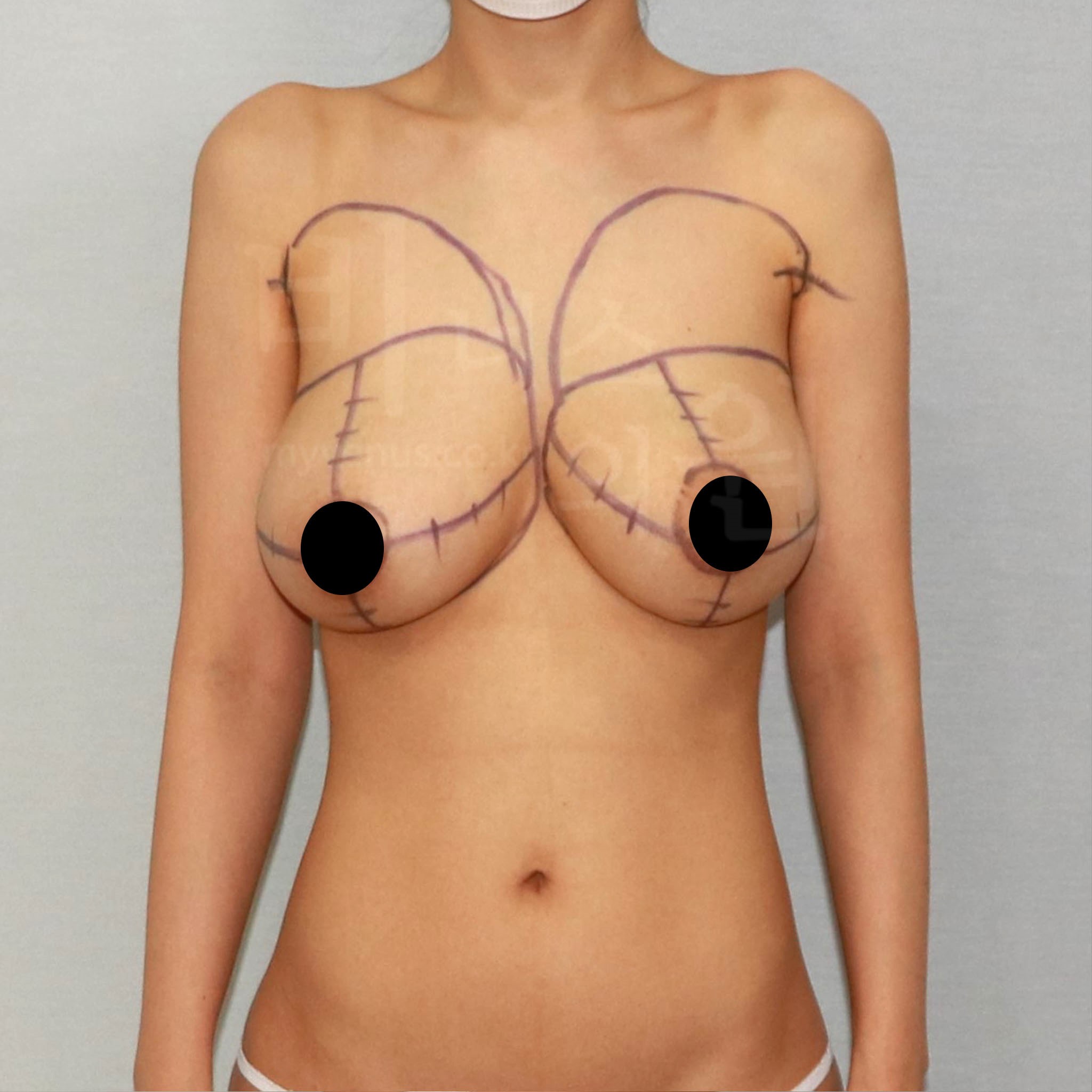 균형 잡힌 라인.JPG