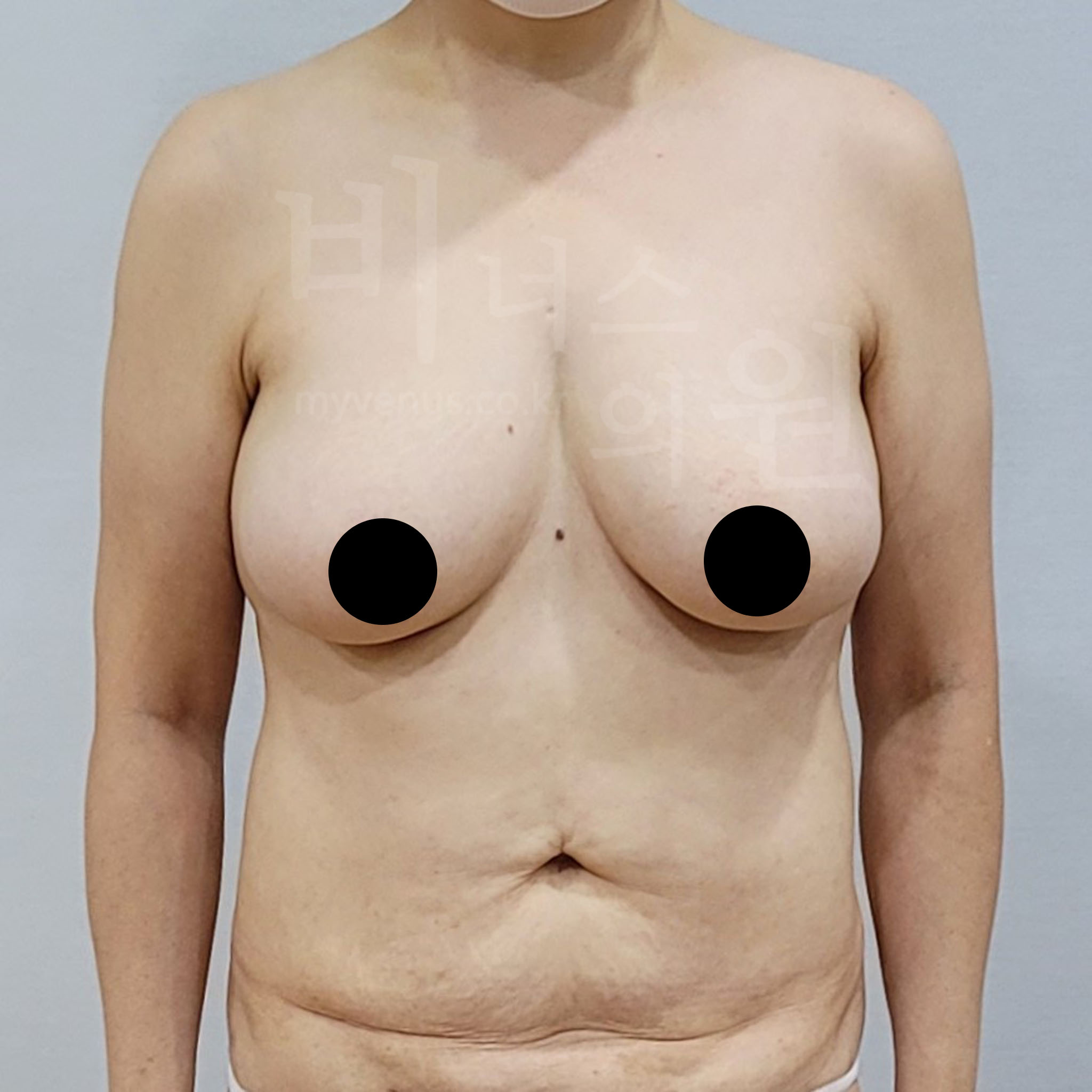압박복.jpg
