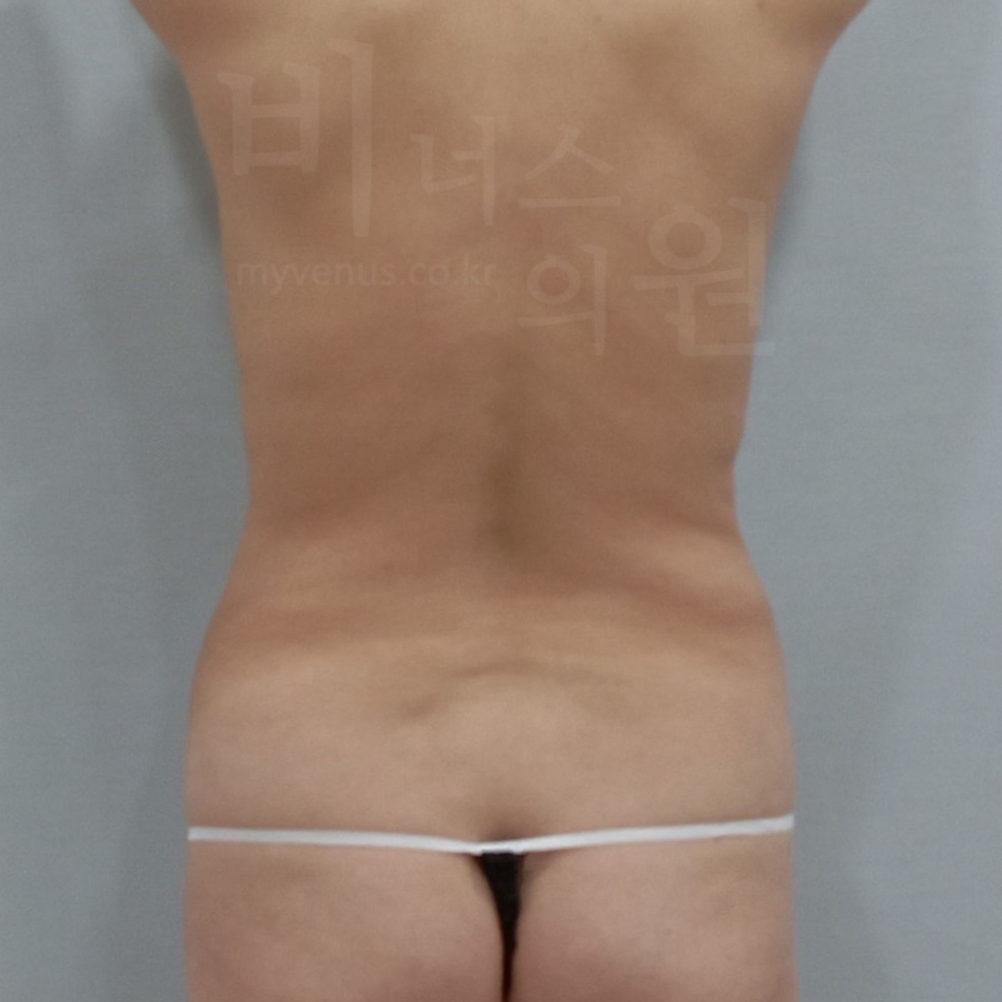 복부 곡선 개선.jpg