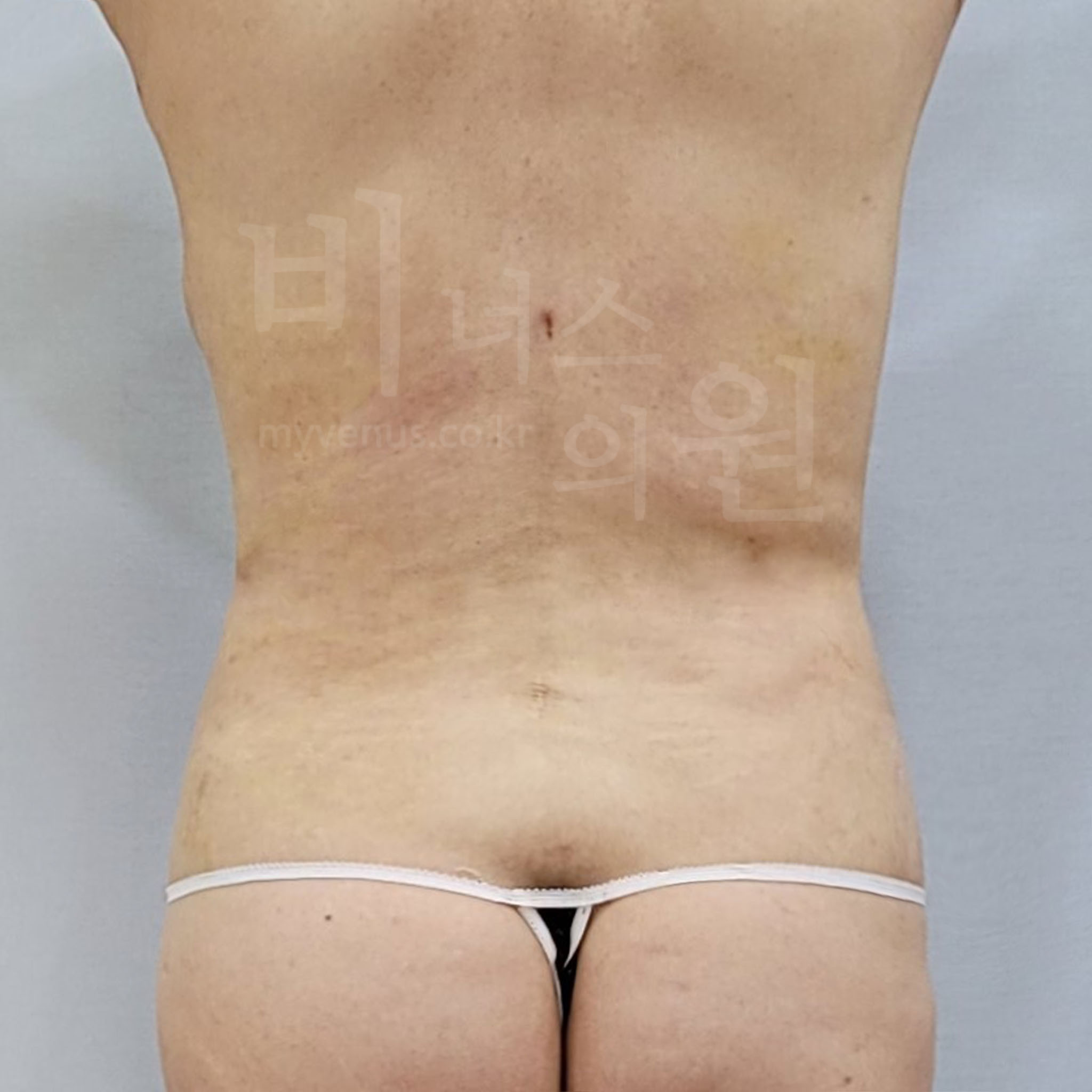 잘록한허리.jpg
