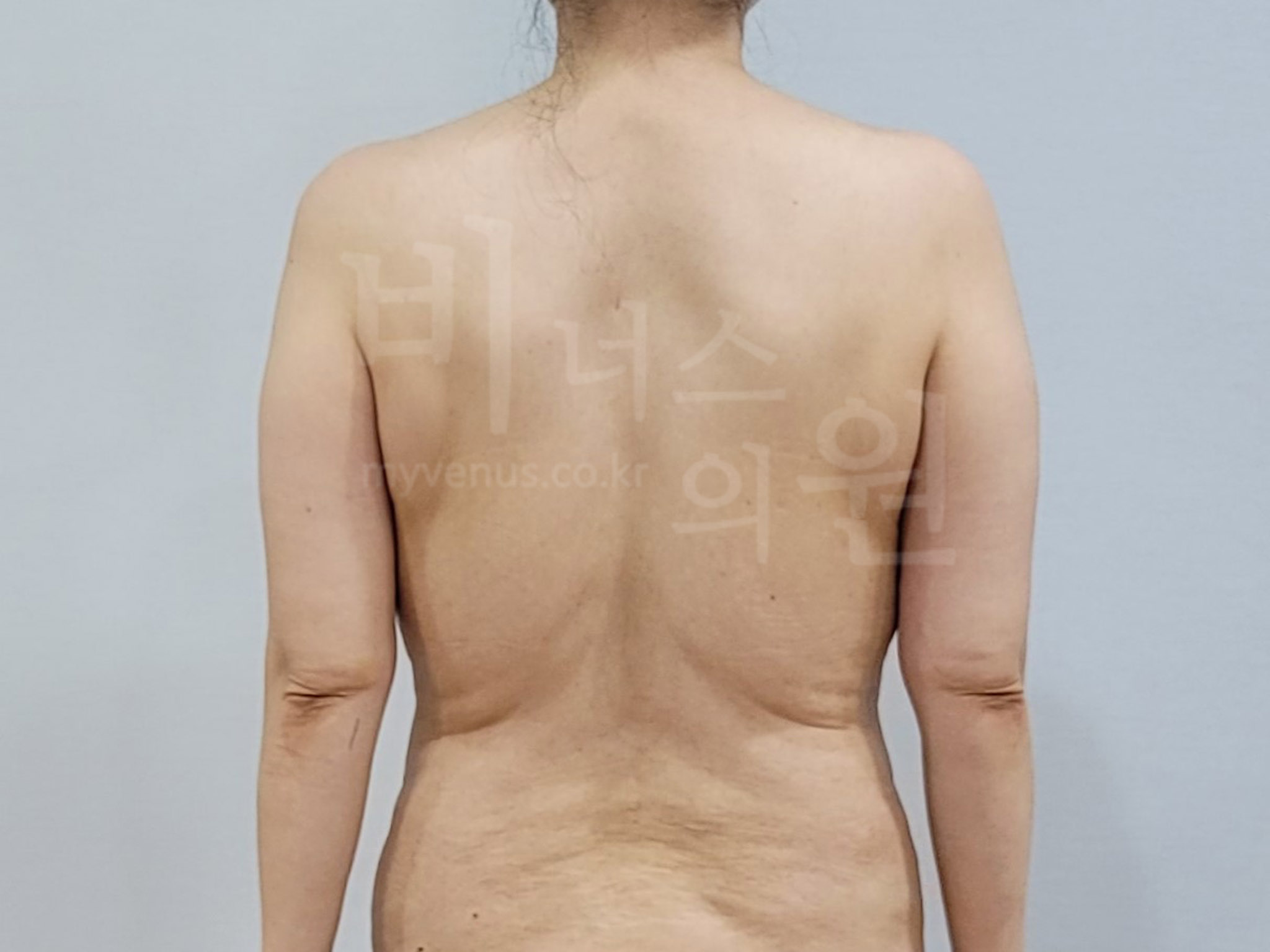 팔뚝다이어트.jpg
