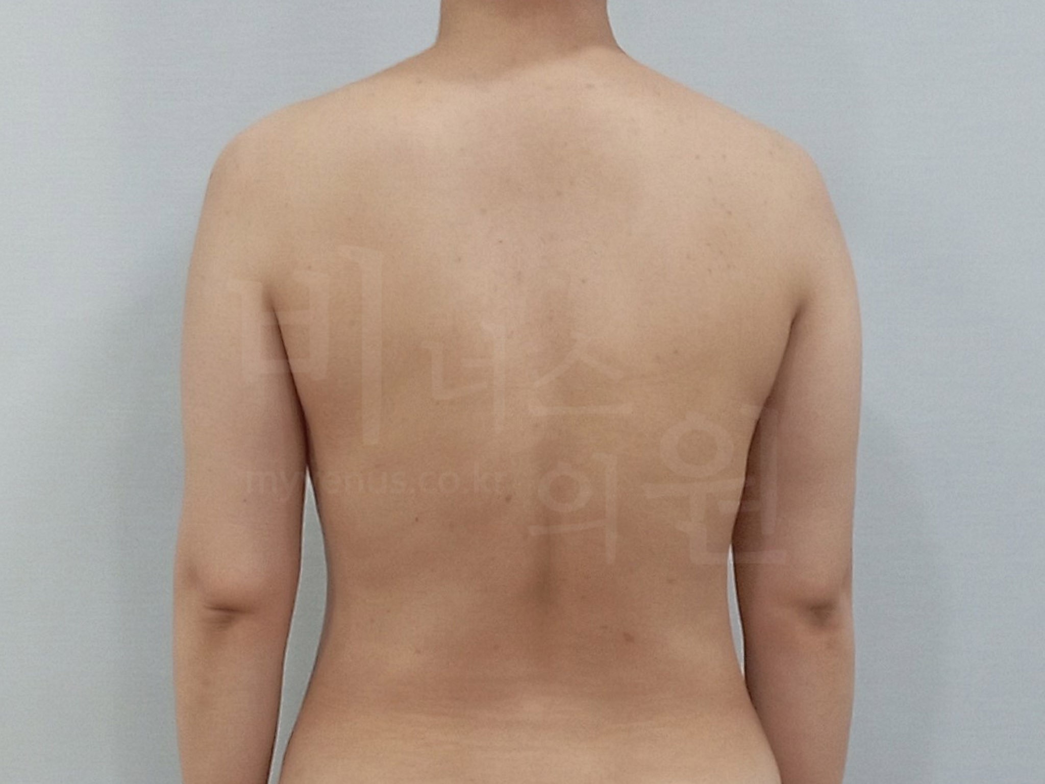 팔뚝변화.jpg