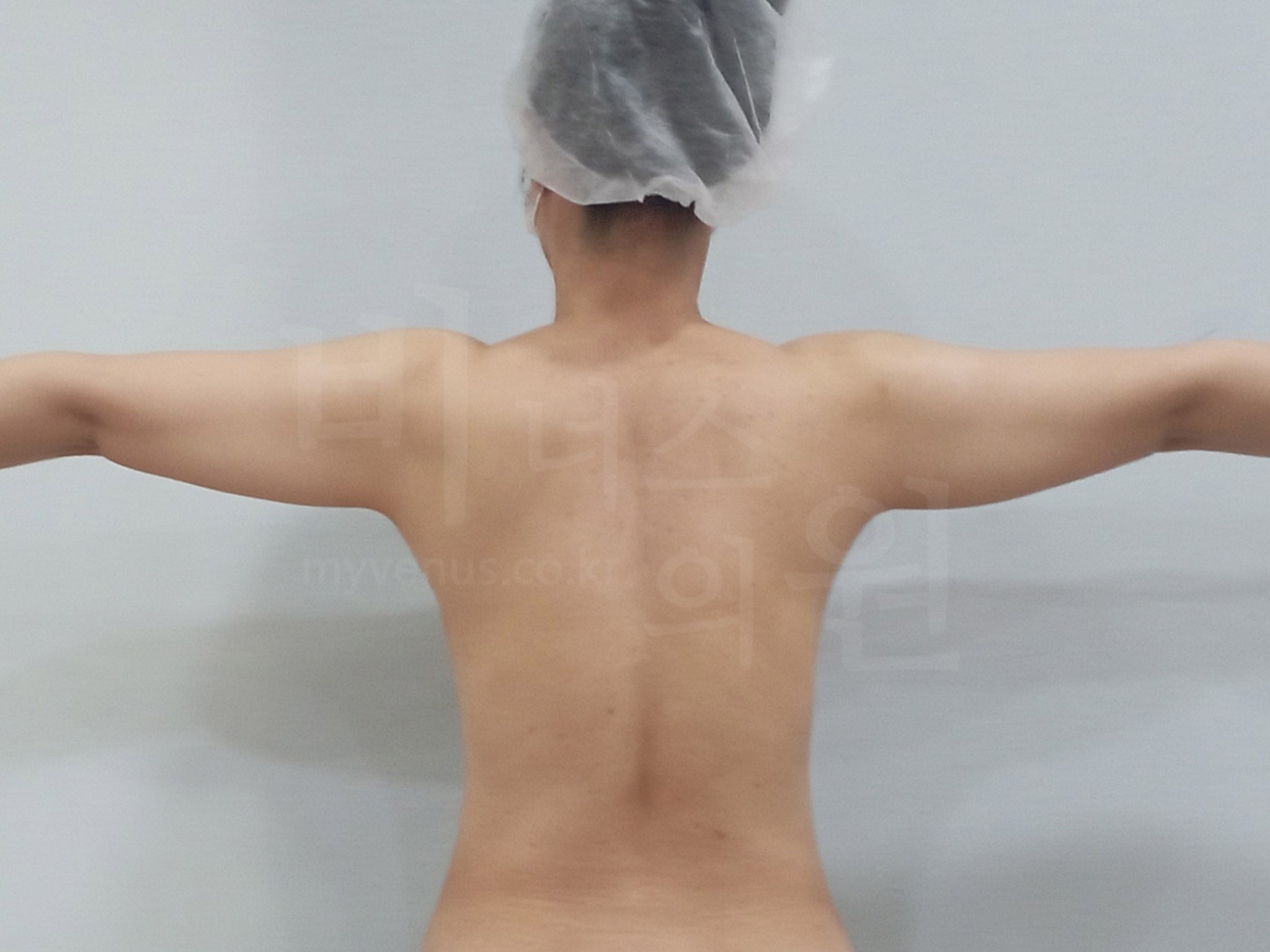 상체비만.jpg