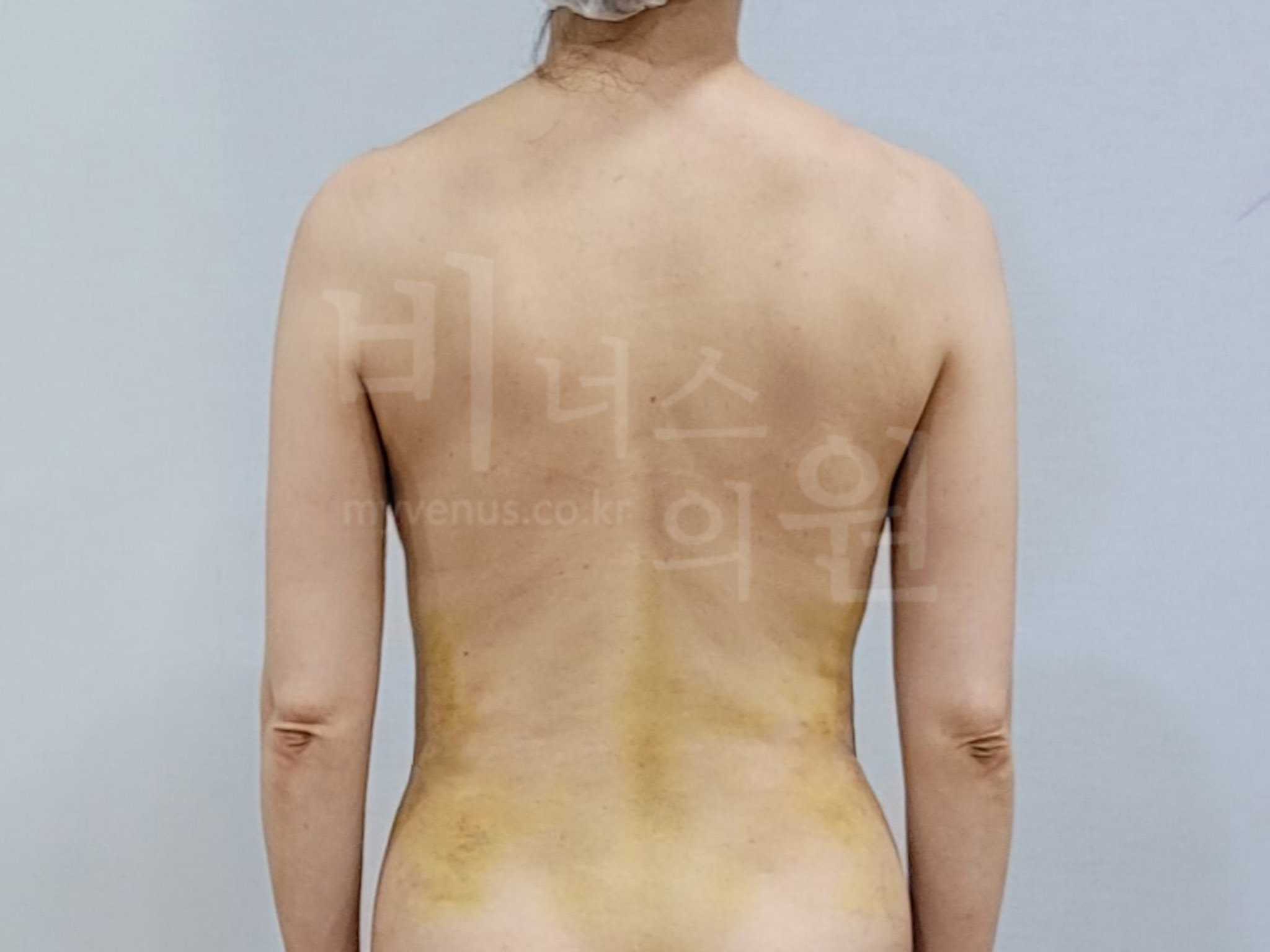 팔처짐.jpg