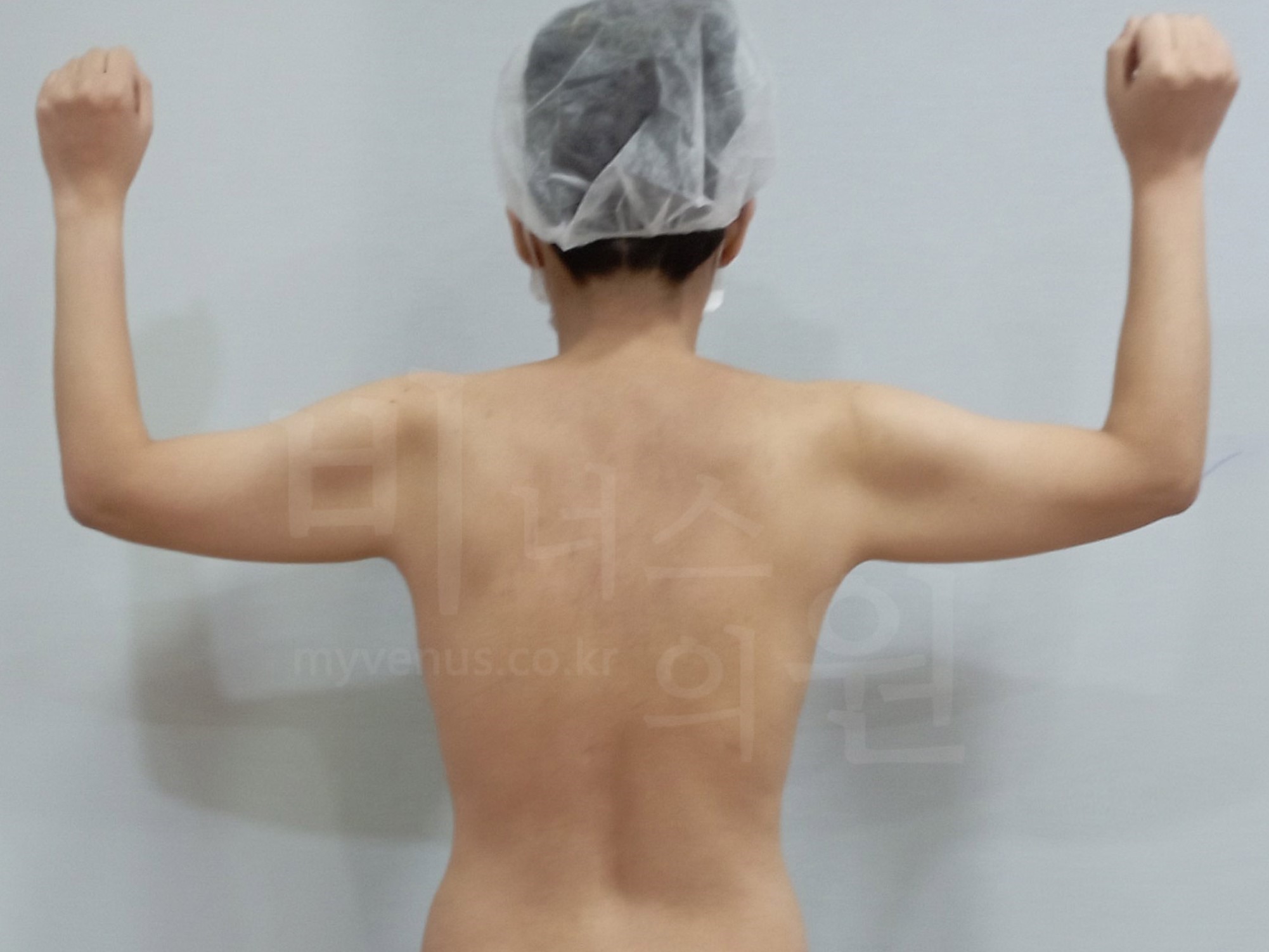 부천체형교정.jpg