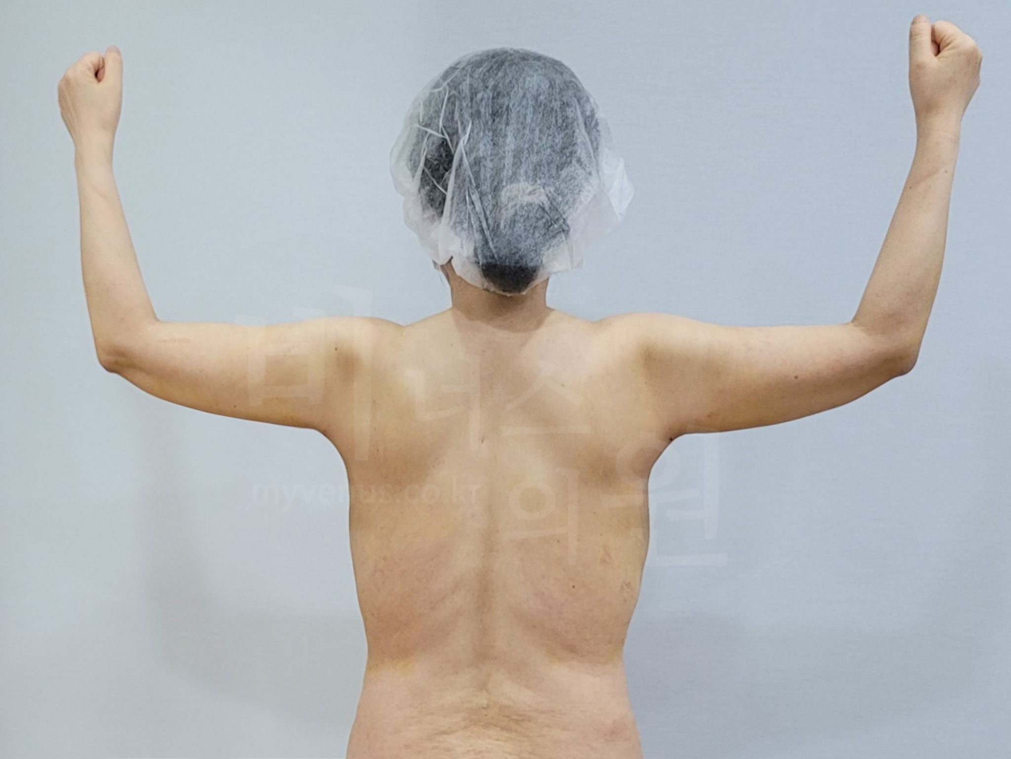 체형변화.jpg