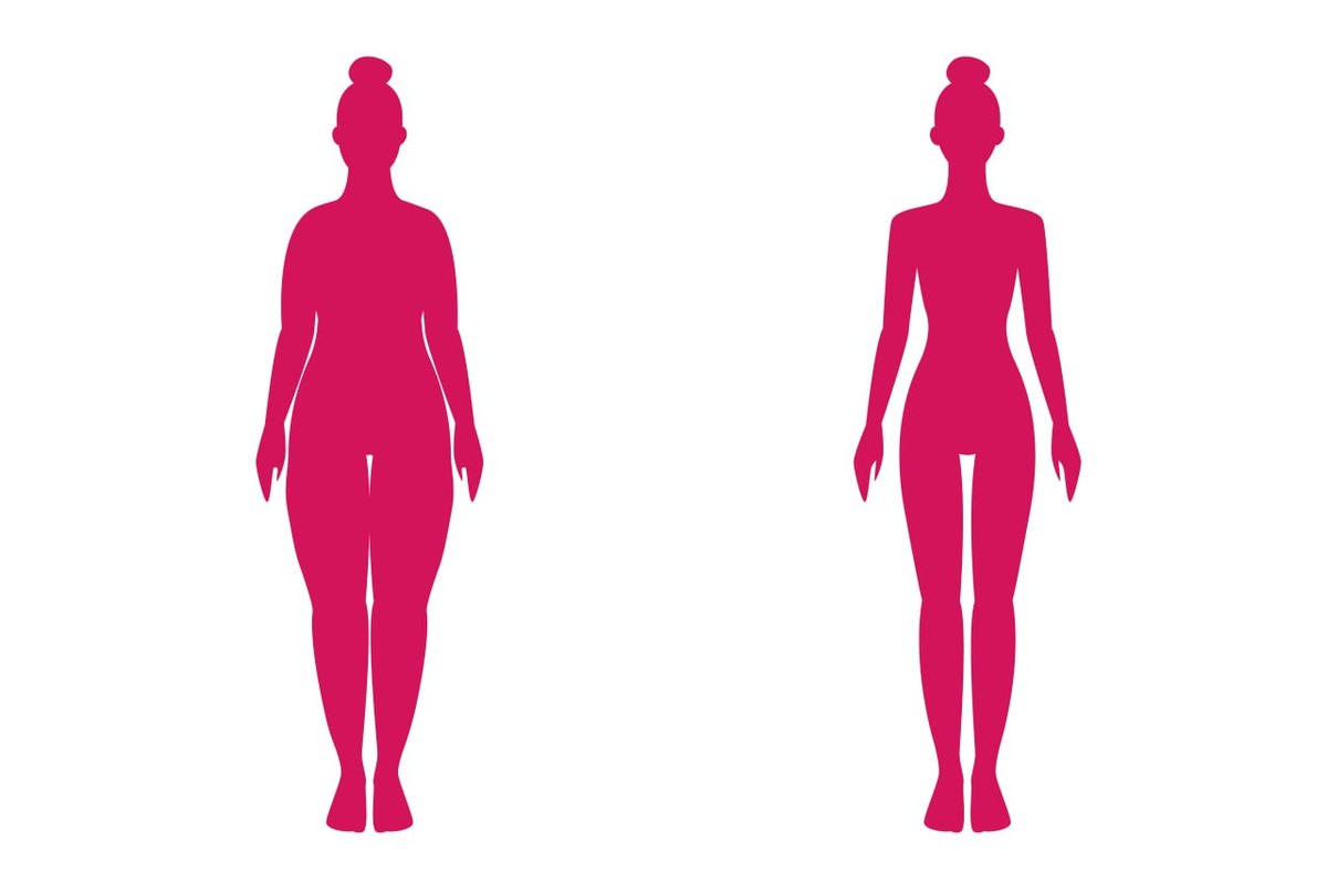 엉덩이 지방흡입 후 일상 복귀 — 수술 회복과 운동 재개