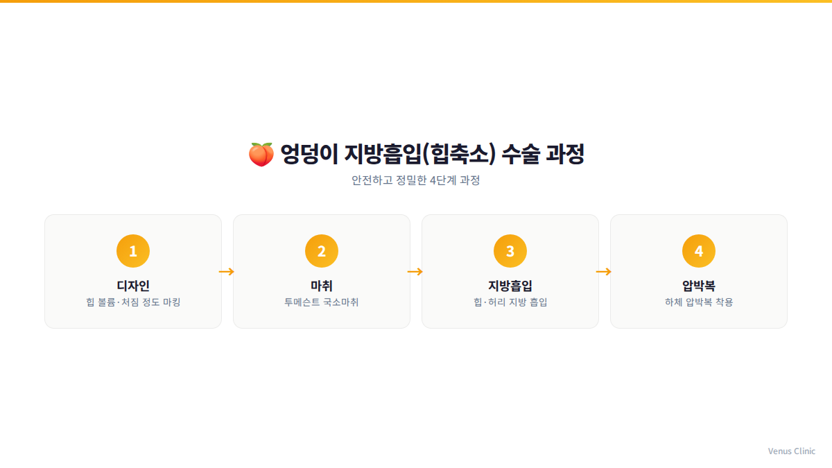 엉덩이축소 지방흡입 수술 4단계 과정 인포그래픽