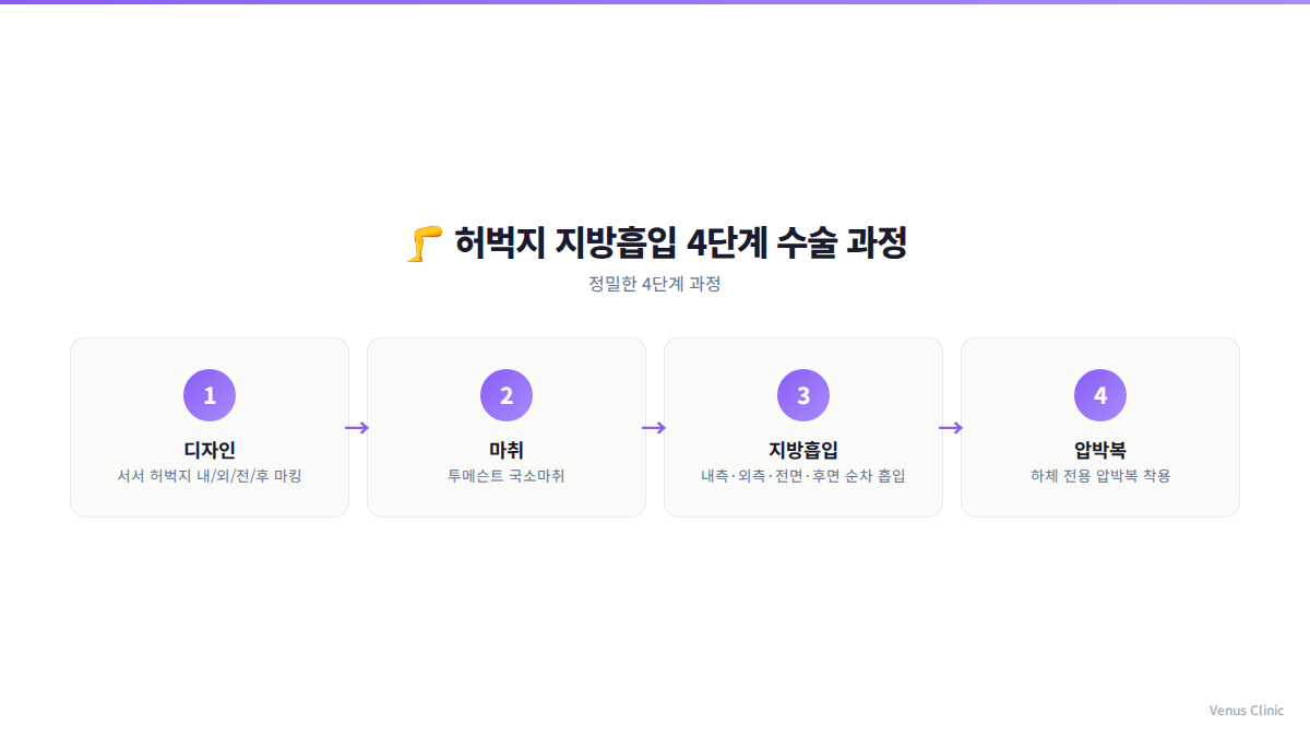 허벅지 지방흡입 4단계 수술 과정 인포그래픽