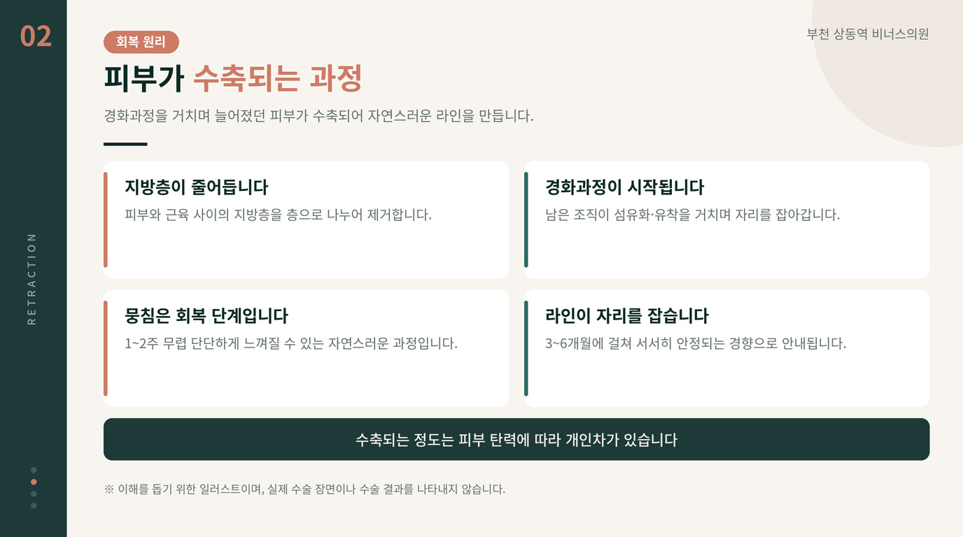 팔뚝지방흡입 경화과정으로 피부가 수축되는 원리 안내 일러스트