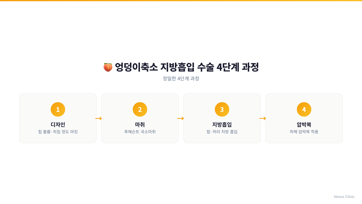 엉덩이축소 지방흡입 수술 4단계 과정 인포그래픽 - 디자인, 마취, 지방흡입, 압박복