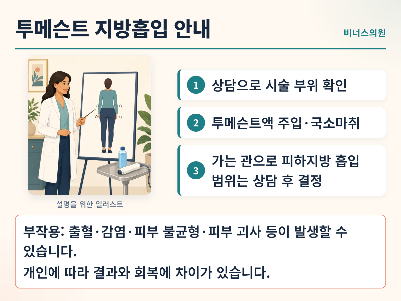 투메슨트 지방흡입의 시술 부위 확인과 방식을 설명한 일러스트 인포그래픽