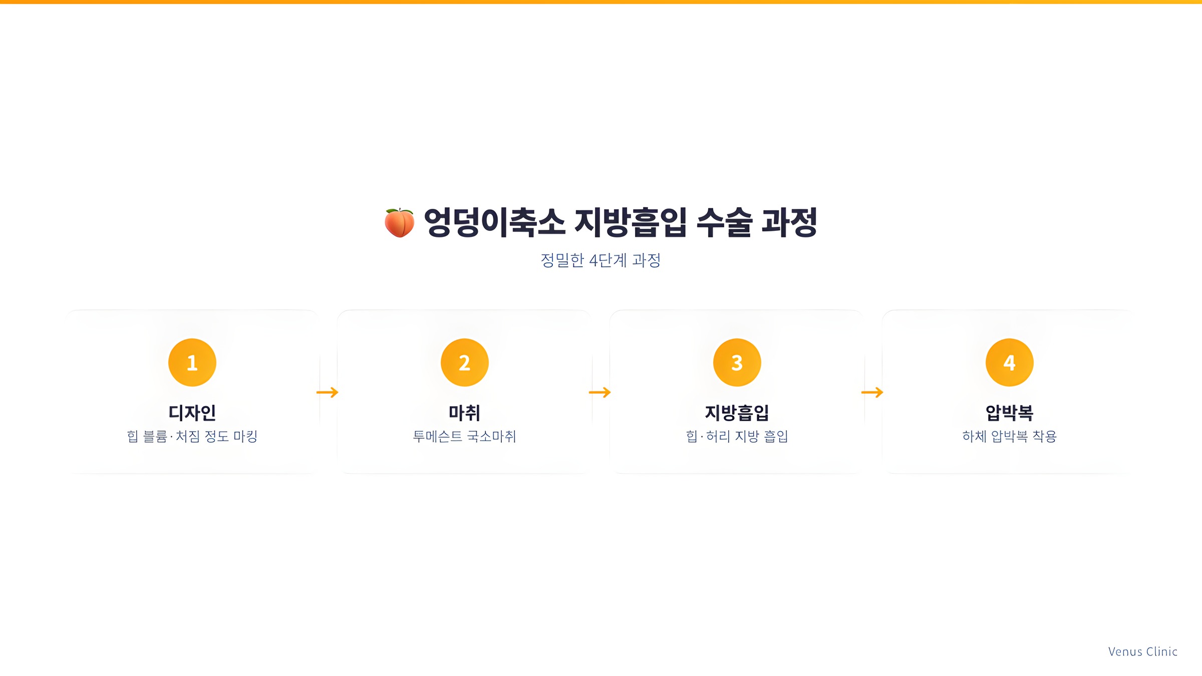 엉덩이축소 지방흡입 수술 4단계 과정 인포그래픽