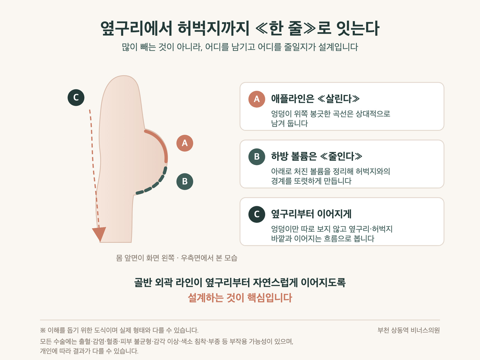 애플라인은 남기고 하방 볼륨은 줄여 옆구리부터 허벅지까지 라인을 잇는 설계 인포그래픽