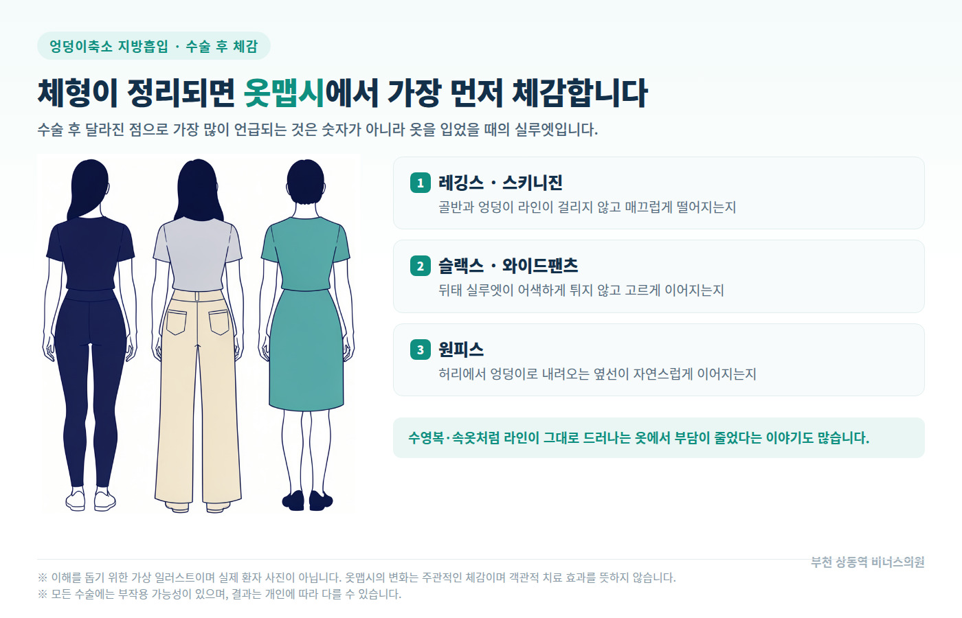 엉덩이축소 지방흡입 후 옷맵시 체감 포인트 인포그래픽 — 레깅스 슬랙스 원피스