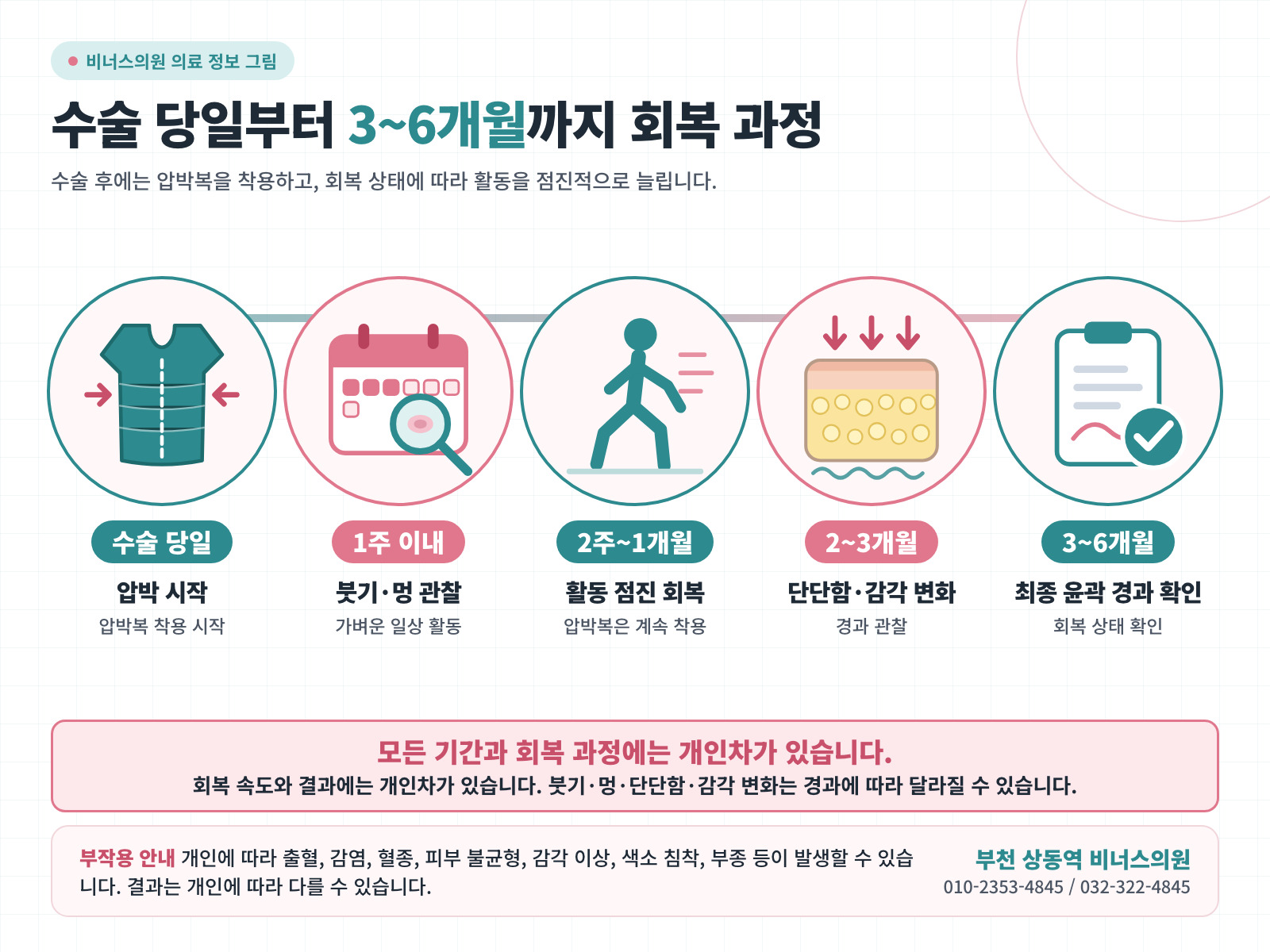 유방 지방흡입 회복 과정 인포그래픽: 수술 당일, 1주 이내, 2주~1개월, 2~3개월, 3~6개월 단계와 개인차 고지 — 부천 상동역 비너스의원