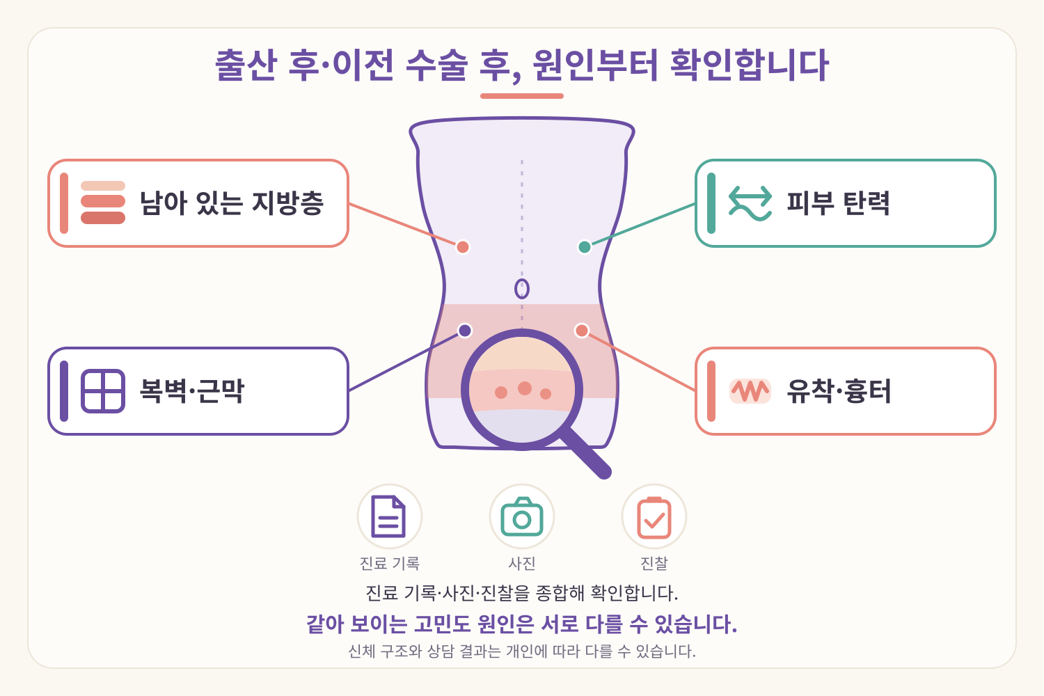출산 후·이전 수술 후 복부 라인 원인 평가 의학 인포그래픽