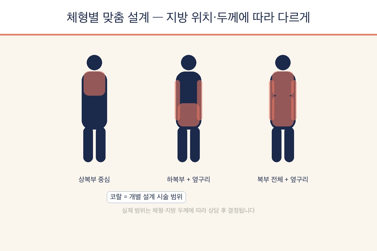 상복부 하복부 옆구리 체형별 맞춤 설계 개념도