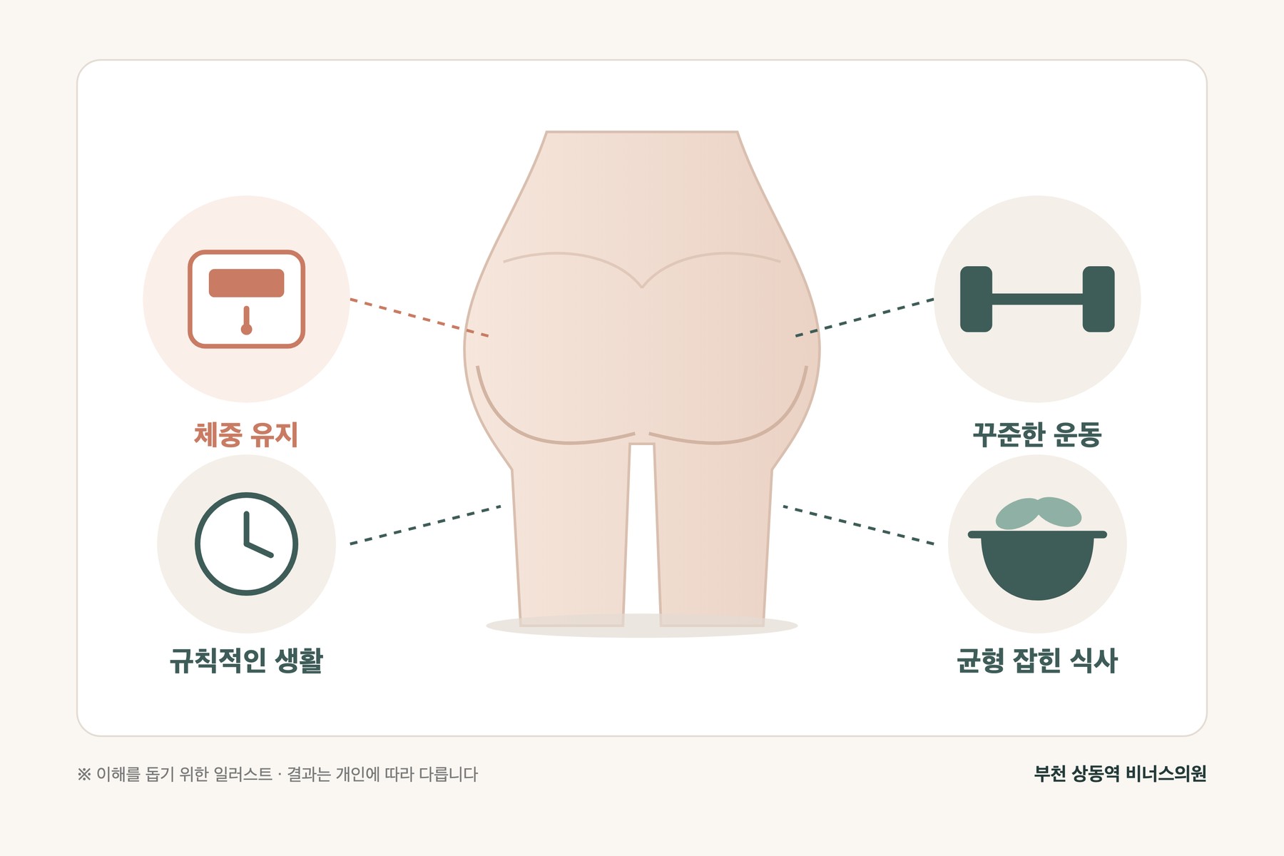 시술 후 체중 유지·운동·식사·규칙적인 생활로 라인을 관리하는 모습을 나타낸 일러스트