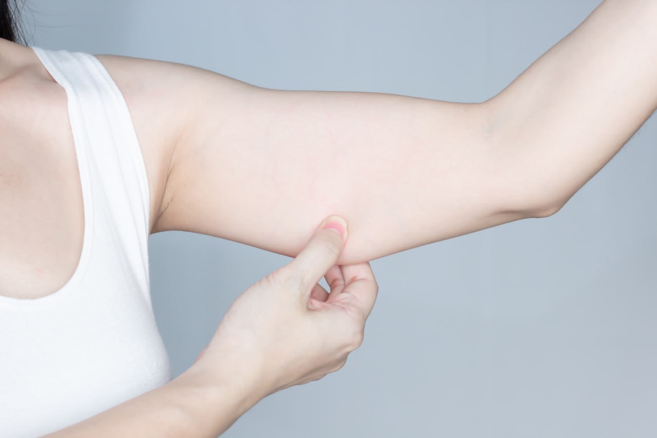 팔뚝 지방흡입 후 달라진 팔 라인 비너스의원